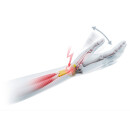 BORT SellaTex® Plus - Quervain - HMNR 23.07.02.2039